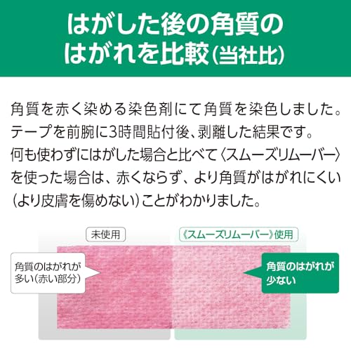 알케어 스무스 리무버 와이프 시트 19812 20매입 4mL 개별포장 이미지 4