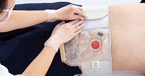 알케어 파라스토마 20912 8cm M 장루 고정 벨트 이미지 2