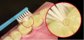 Ci메디컬 Ci700 블루 1입 초극세 라운드모 칫솔 보통 이미지 3