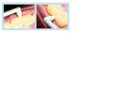 Ci메디컬 미크린 원터프트 칫솔 M 메탈릭실버 1입 이미지 6