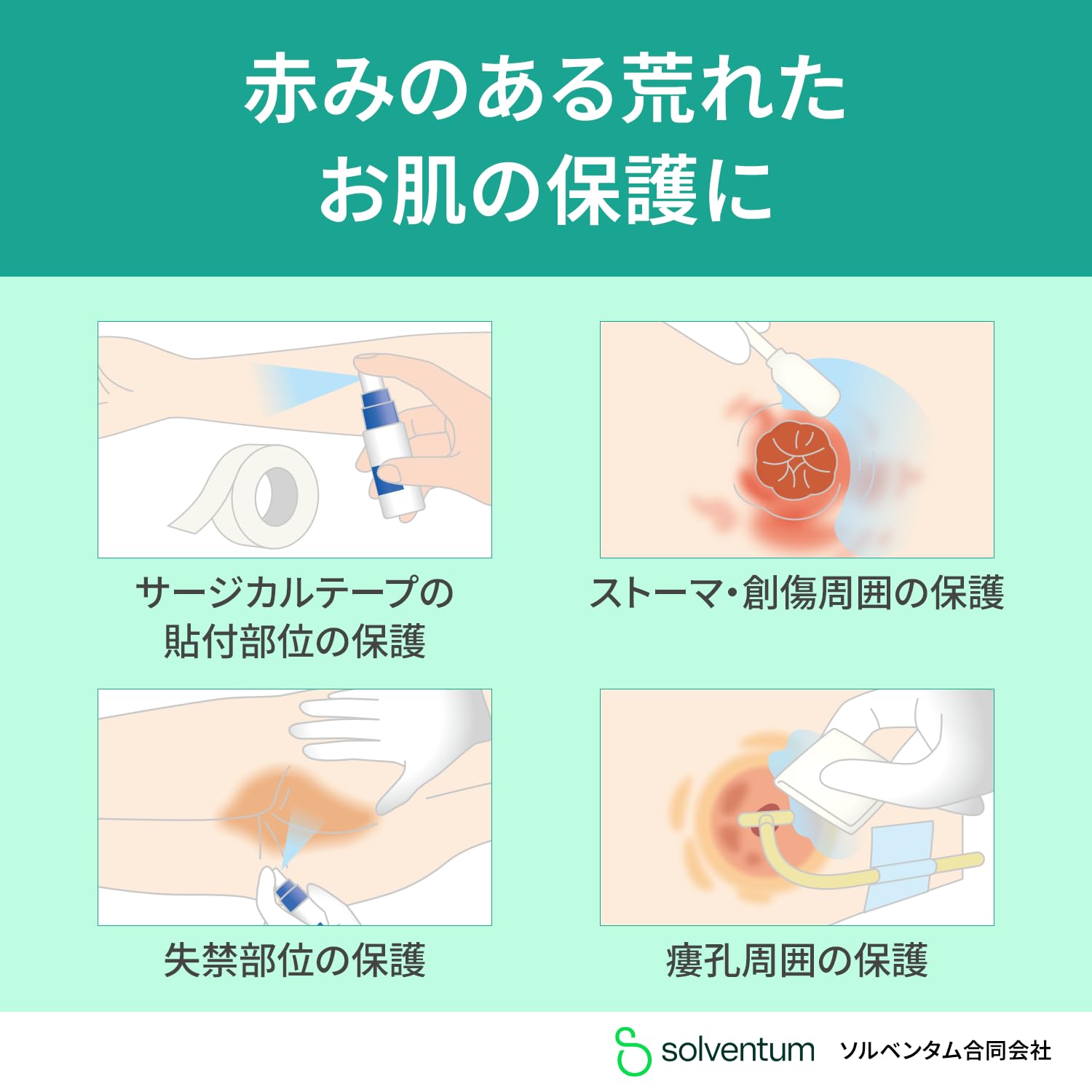 3M 캐빌론 3344E 1ml 5팩 1ml 5팩 냅킨형 멸균 이미지 3
