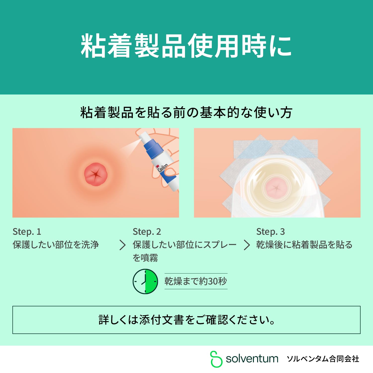 3M 캐빌론 3344E 1ml 5팩 1ml 5팩 냅킨형 멸균 이미지 5