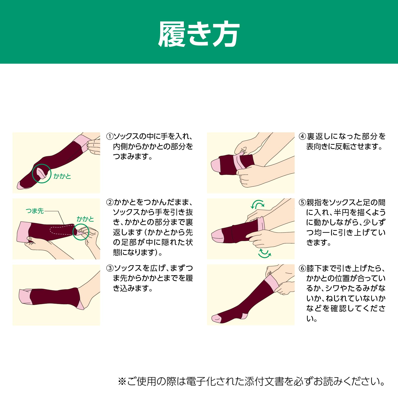알케어 안실크 키라리 적색 21644 L 의료용 압박스타킹 파일소재 이미지 6