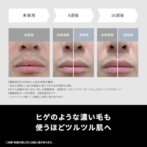 파나소닉 스무스에피 그레이 ES-WG0B-H 광조사기 쿨링 제모기 이미지 5
