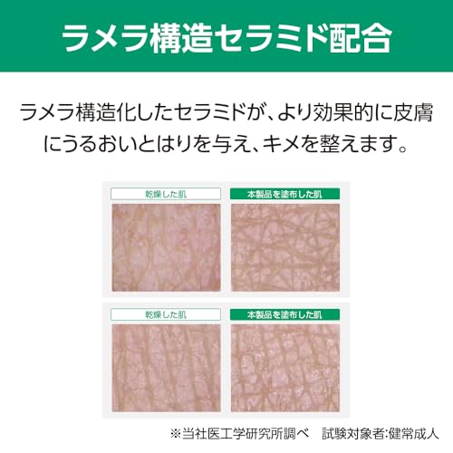 알케어 리모이스 라멜라 보습 밀크 21352 150ml 이미지 5